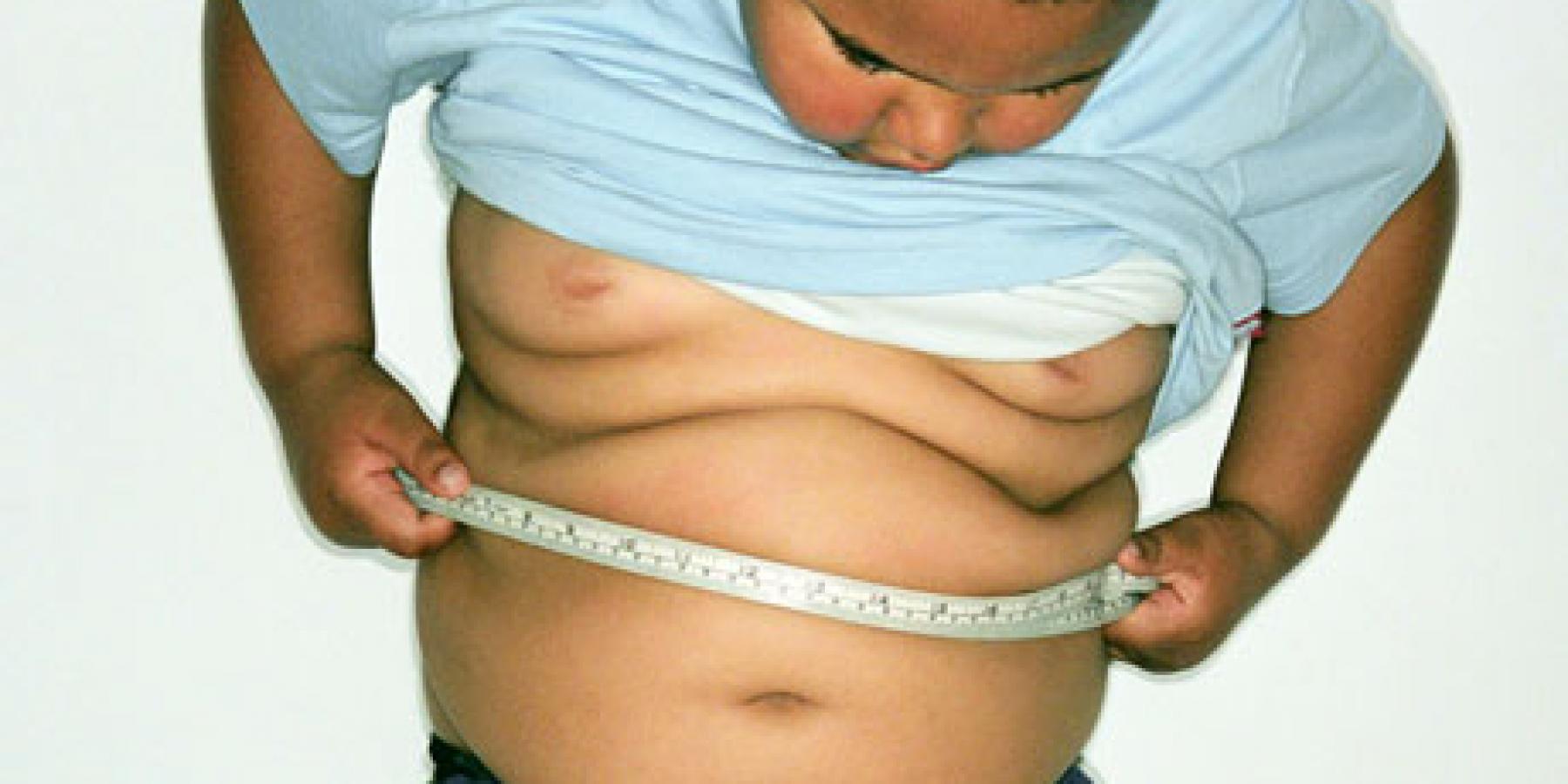 Морбидное ожирение у детей