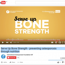 Serve Up Bone Strength - preventing osteoporosis through nutrition