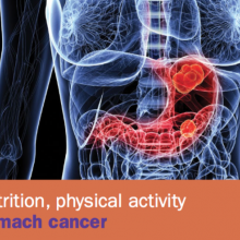 Worldwide research on stomach cancer
