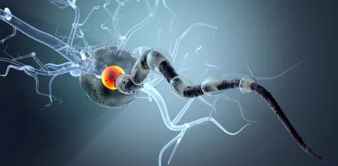 Neurological disorders neurons concept picture 